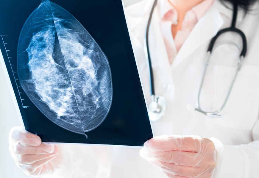 Breast Health at Hillsboro Healthcare